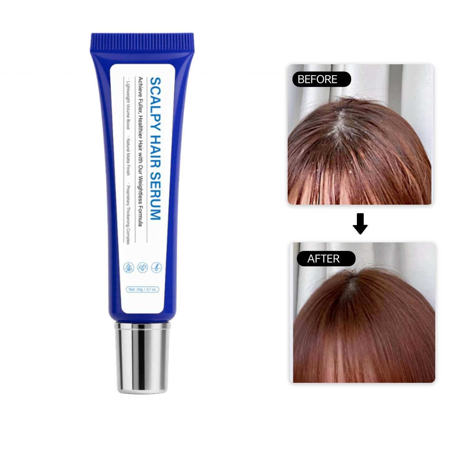 Scalp Hair Repair 20g Scalpy Hair Serum